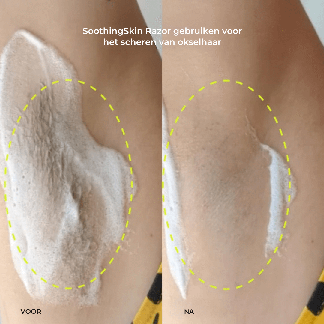 SoothingSkin Original Razor