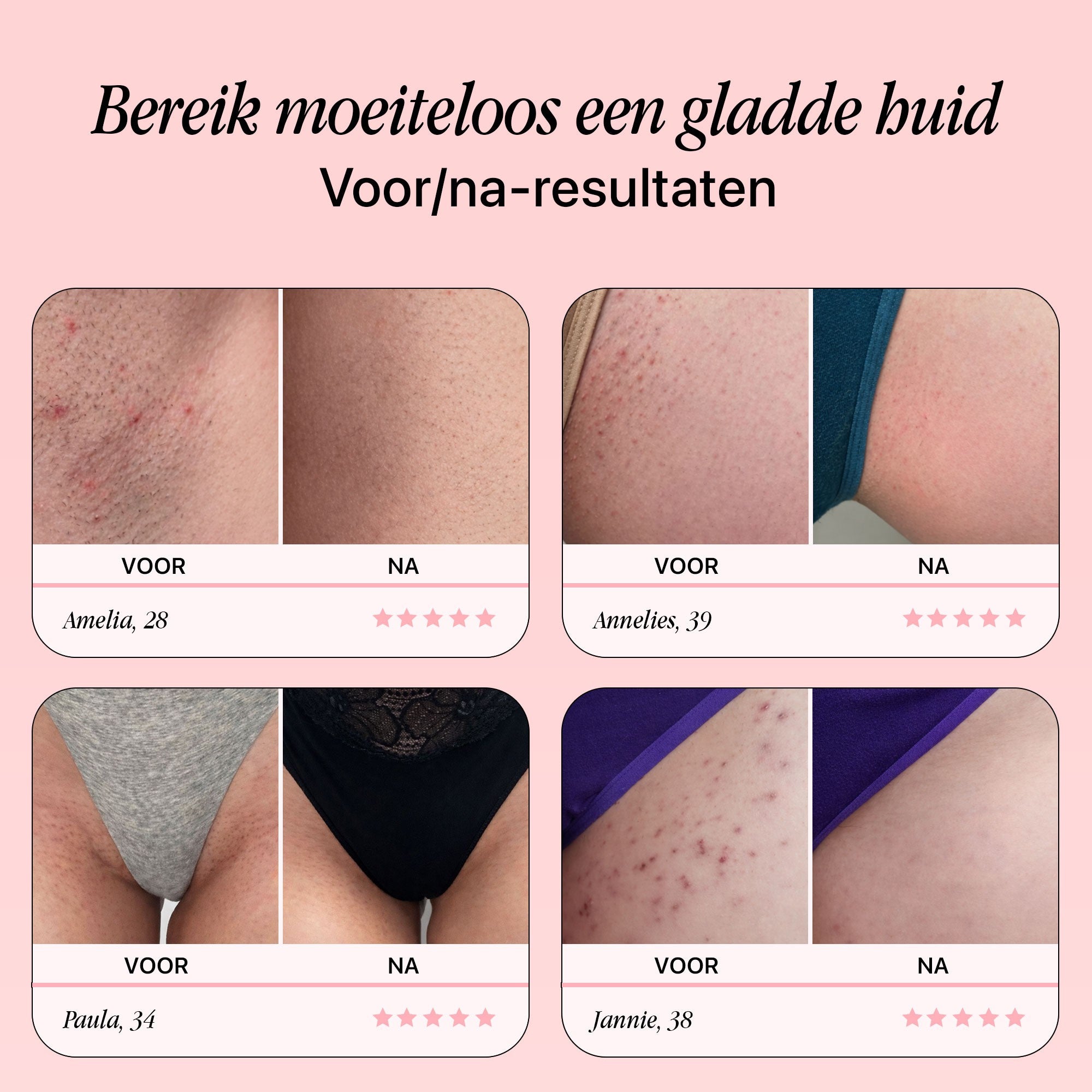 Original Razor - Tijdelijk 10 reservemesjes GRATIS