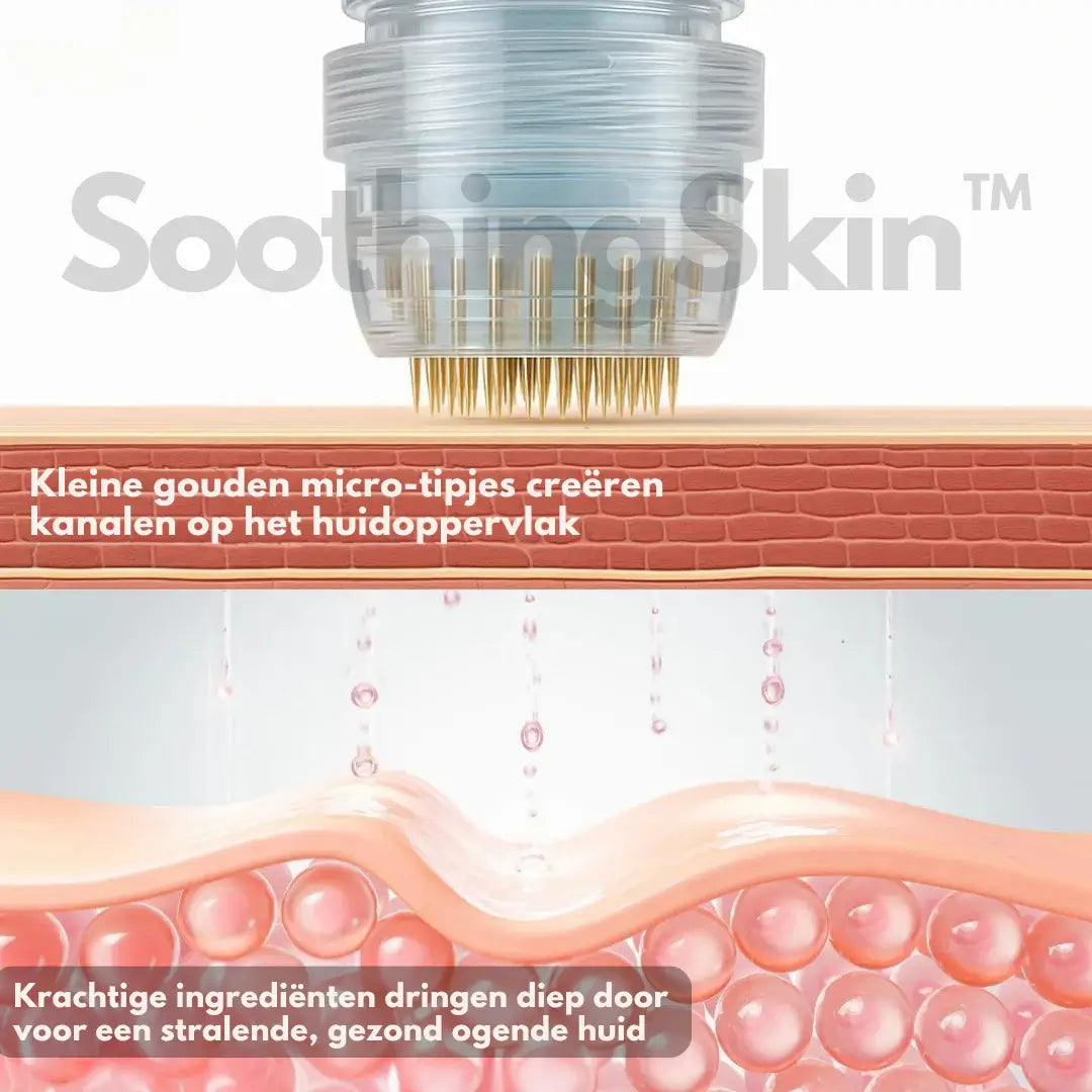 SoothingSkin Micro infuus systeem