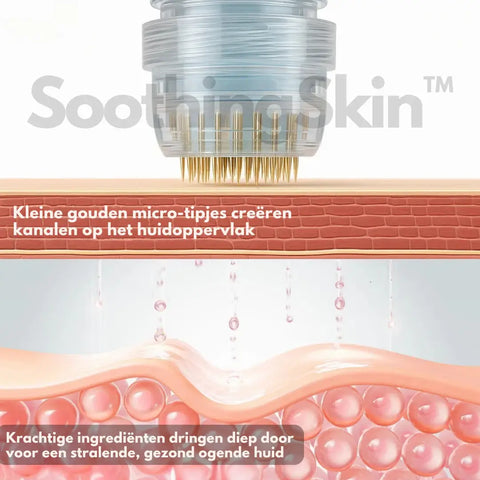 SoothingSkin Micro infuus systeem